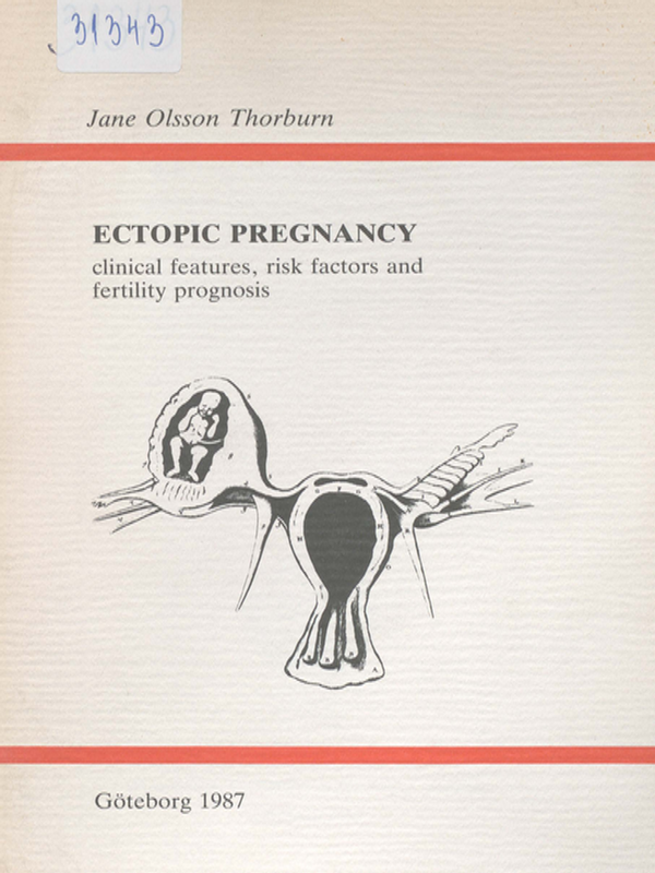 Ectopic pregnancy