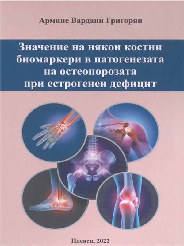 Значение на някои костни биомаркери в патогенезата на остеопорозата при естрогенен дефицит