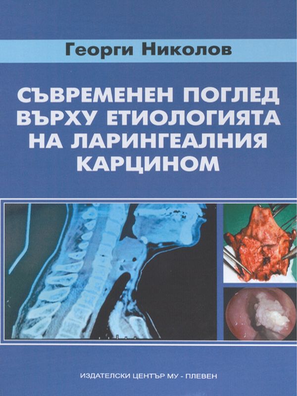Съвременен поглед върху етиологията на ларингеалния карцином