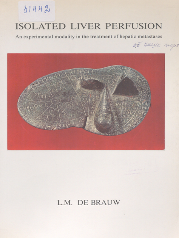 Isolated liver perfusion