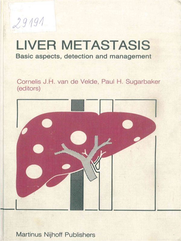 Liver metastasis