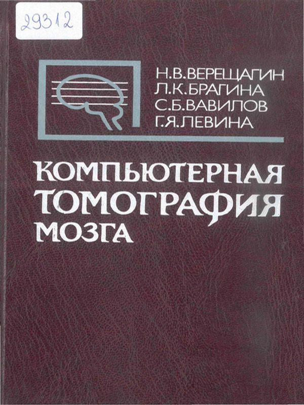 Компьютерная томография мозга