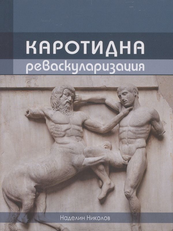 Каротидна реваскуларизация