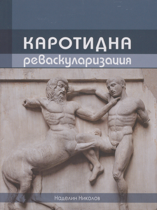 Каротидна реваскуларизация