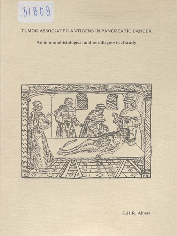 Tumour associated antigens in pancreatic cancer