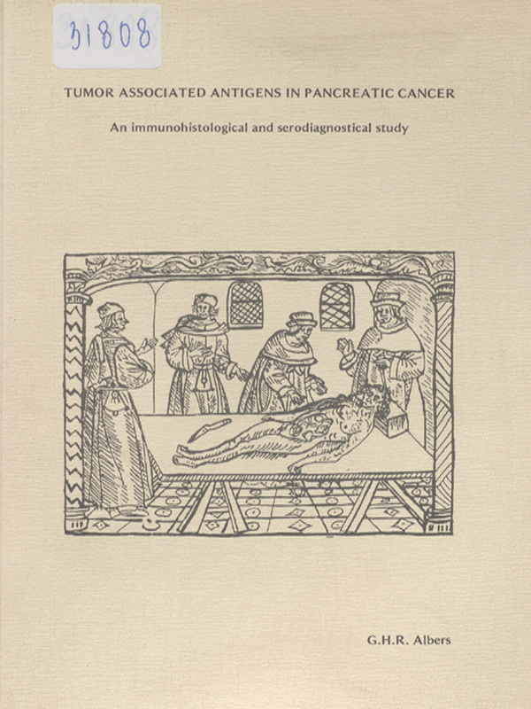 Tumour associated antigens in pancreatic cancer