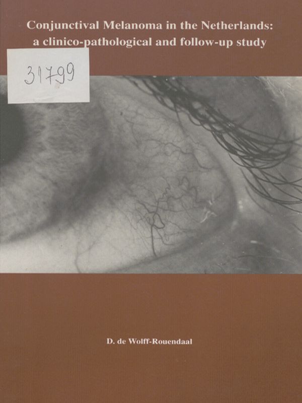 Conjunctival Melanoma in the Netherlands