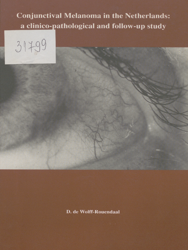 Conjunctival Melanoma in the Netherlands