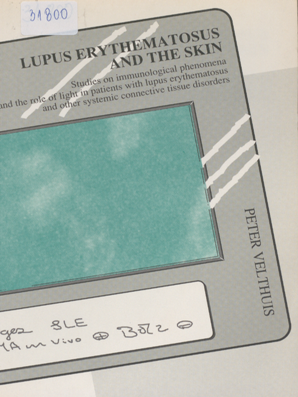 Lupus erythematosus and the skin
