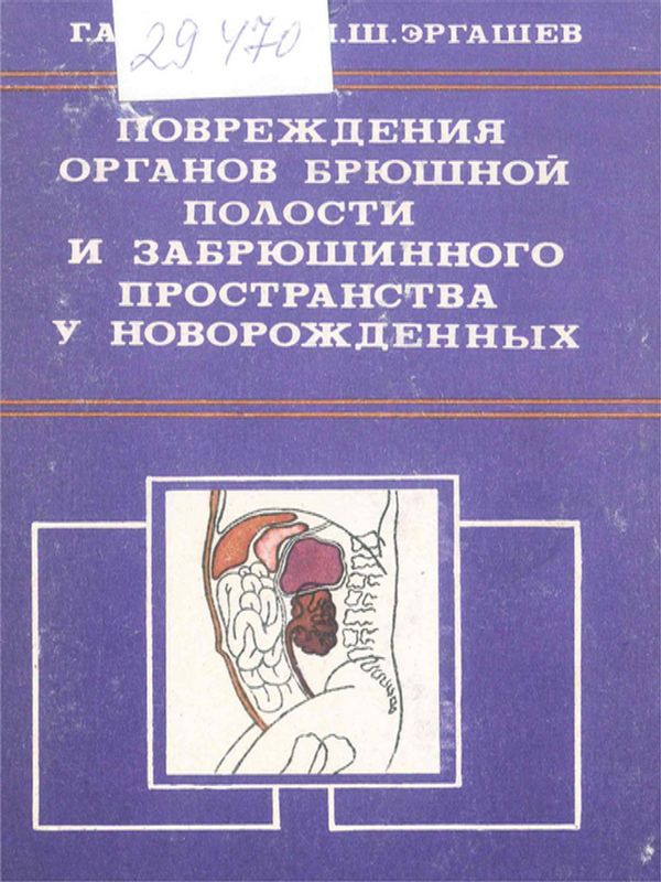 Повреждения органов брюшной и забрюшинного пространства у новорожденных