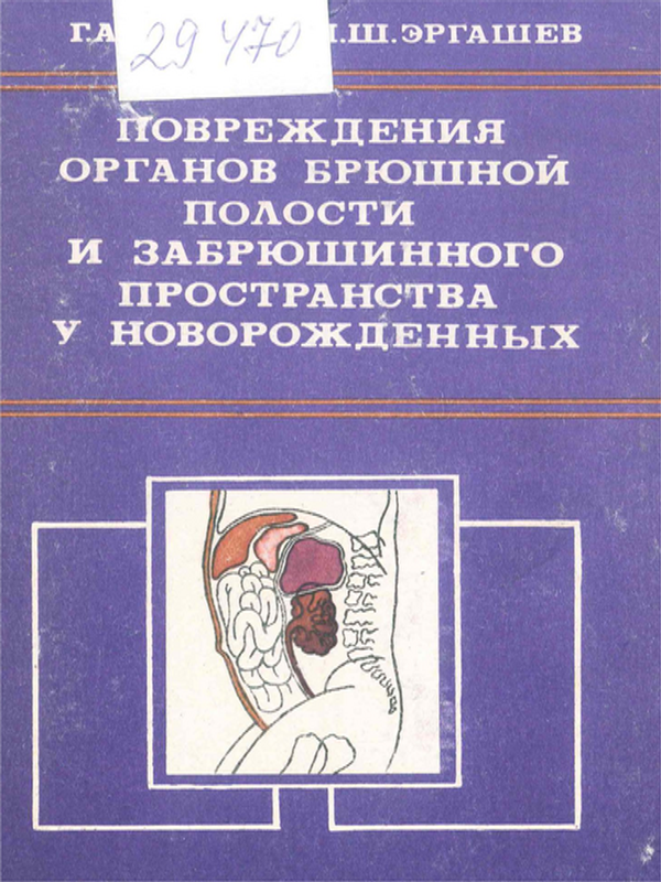 Повреждения органов брюшной и забрюшинного пространства у новорожденных