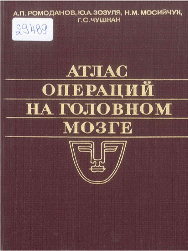 Атлас операций на головном мозге
