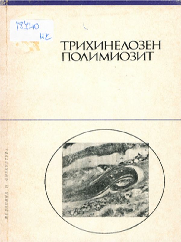 Трихинелозен полимиозит