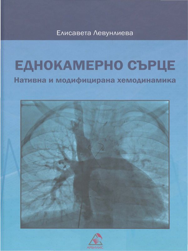 Еднокамерно сърце