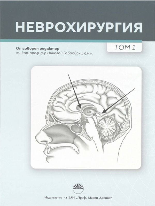 Неврохирургия