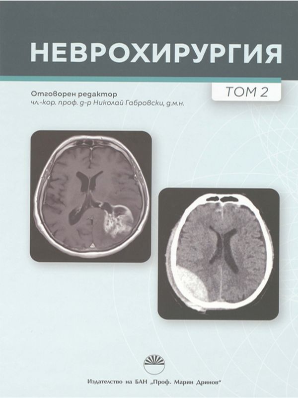 Неврохирургия