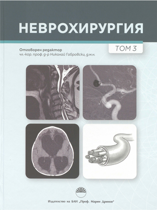 Неврохирургия