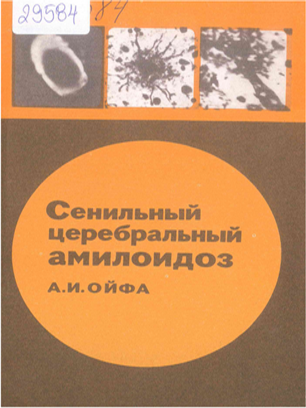 Сенильный церебральный амилоидоз