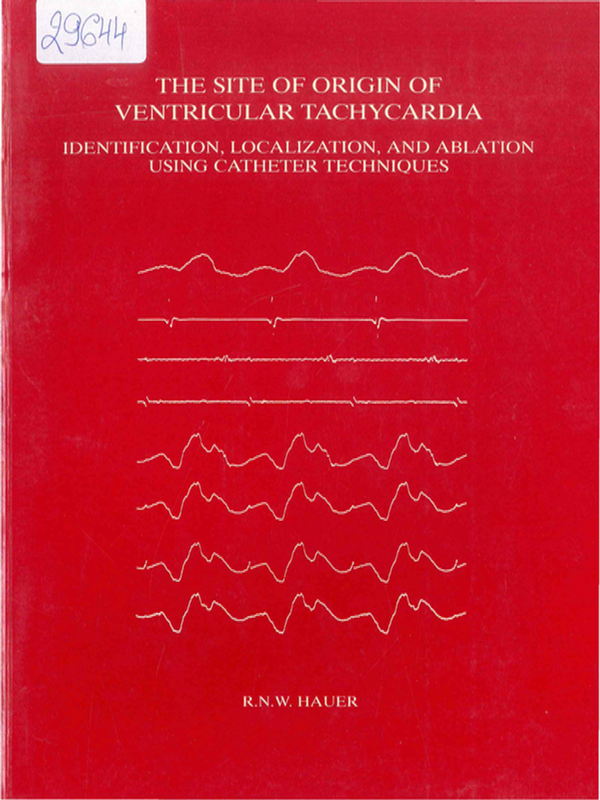 The site of origin of ventricular tachycardia