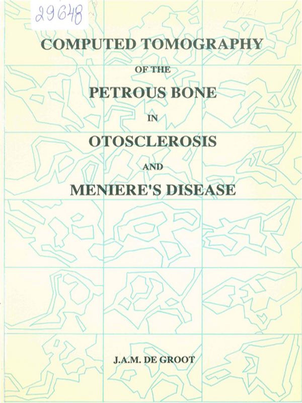 Computed tomography of the petrous bone in otosclerosis and Meniere's disease