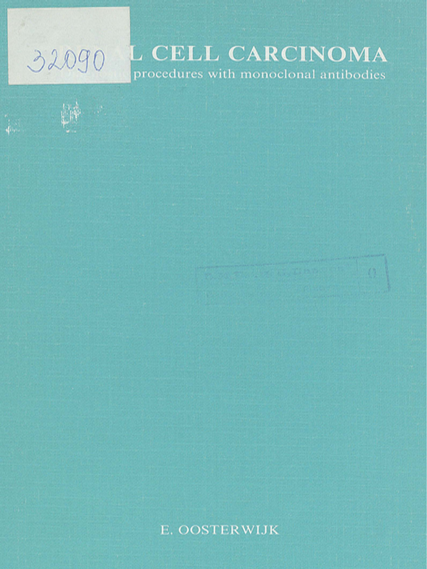Renal cell carcinoma