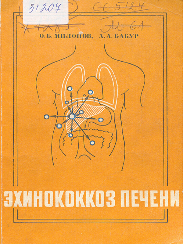 Эхинококкоз печени