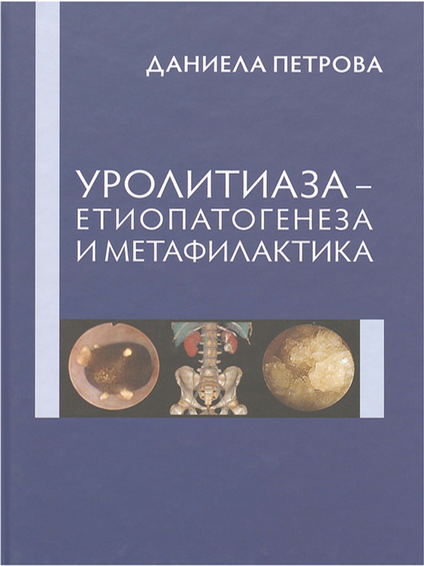 Уролитиаза - етиопатогенеза и метафилактика