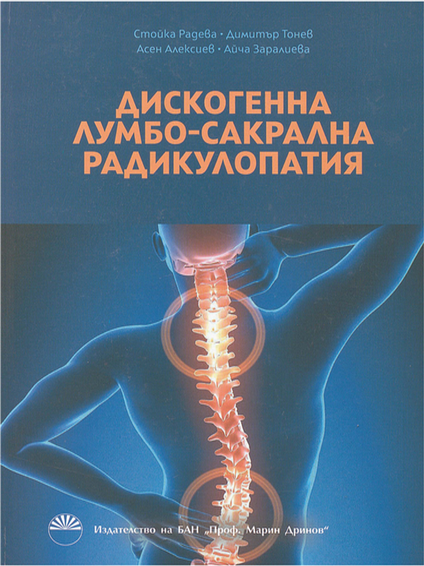 Дискогенна лумбо-сакрална радикулопатия