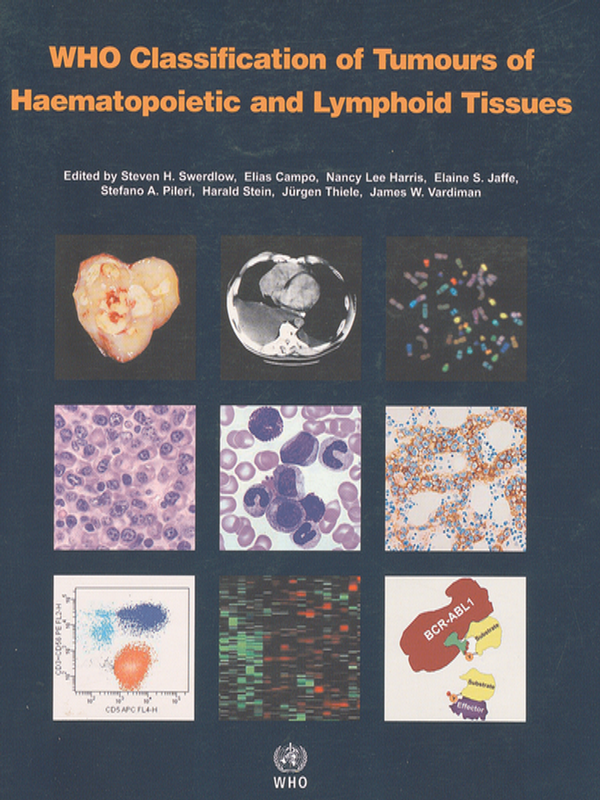 WHO classification of tumours of haematopoietic and lymphoid tissues