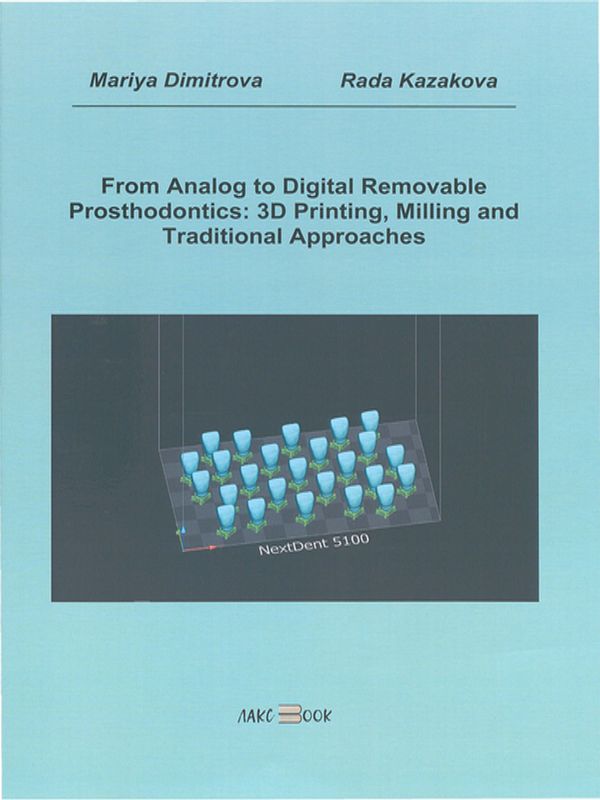 From analog to digital removable prosthodontics: 3D printing, milling and traditional approaches