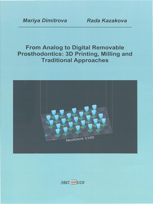From analog to digital removable prosthodontics: 3D printing, milling and traditional approaches