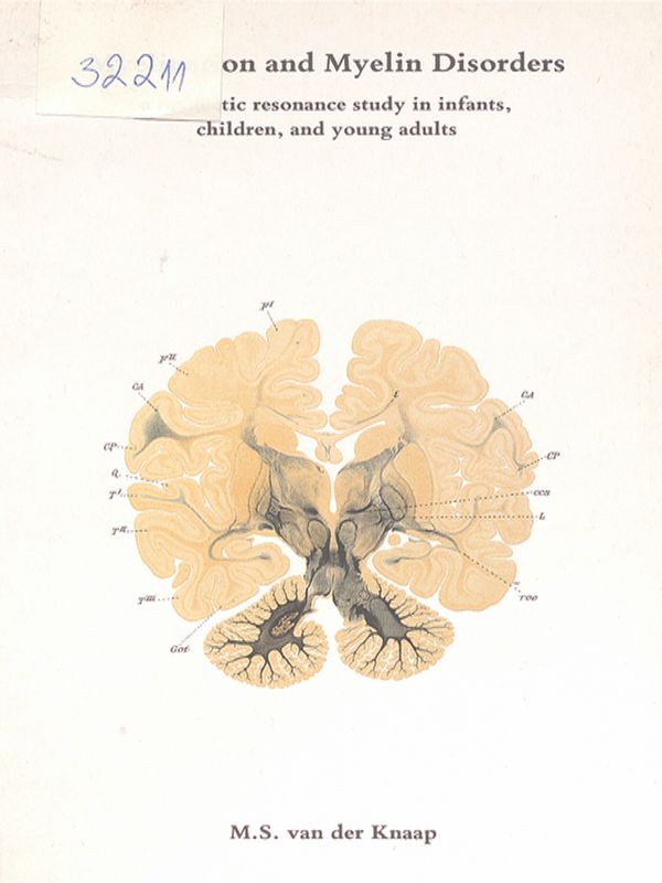 Myelination and myelin disorders