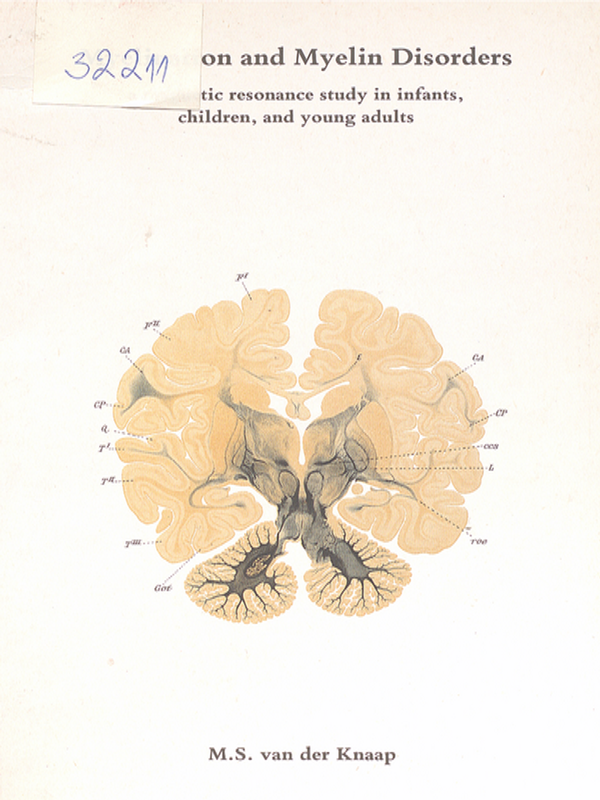 Myelination and myelin disorders