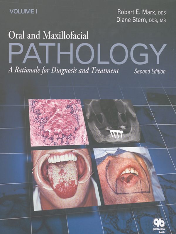 Oral and maxillofacial pathology : A rationale for diagnosis and treatment