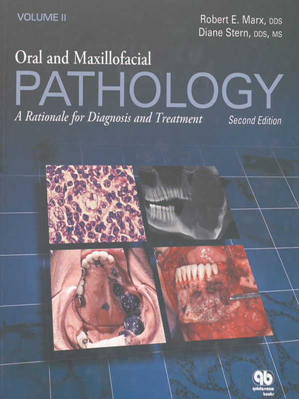 Oral and maxillofacial pathology : A rationale for diagnosis and treatment