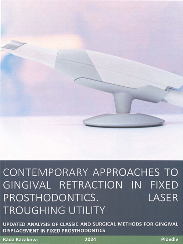 Contemporary approaches to gingival retraction in fixed prosthodontics. Laser troughing utility