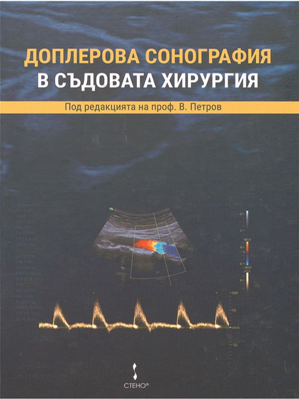 Доплерова сонография в съдовата хирургия