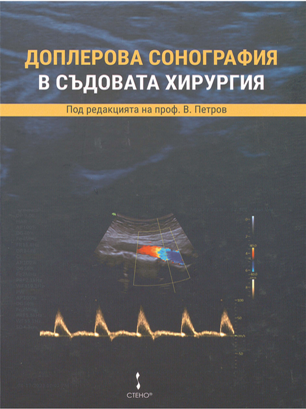 Доплерова сонография в съдовата хирургия