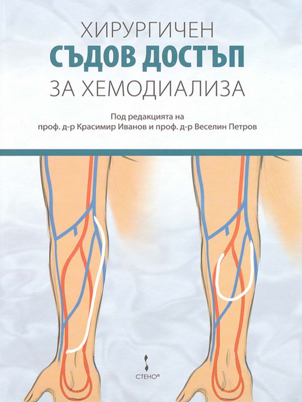 Хирургичен съдов достъп за хемодиализа