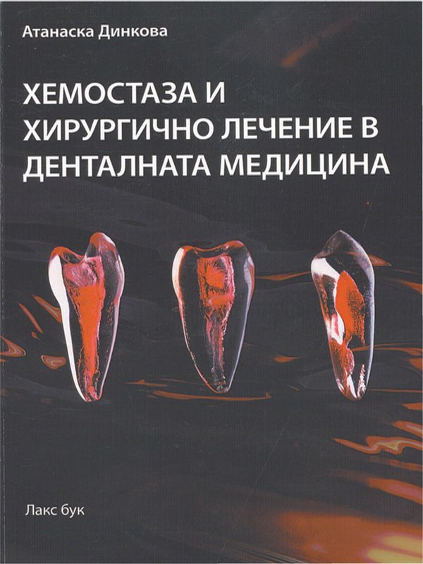 Хемостаза и хирургично лечение в денталната медицина
