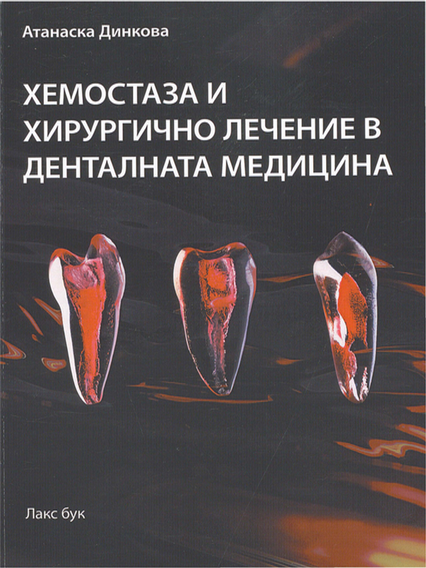 Хемостаза и хирургично лечение в денталната медицина