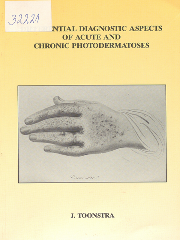 Differential diagnostic aspects of acute and chronic photodermatoses