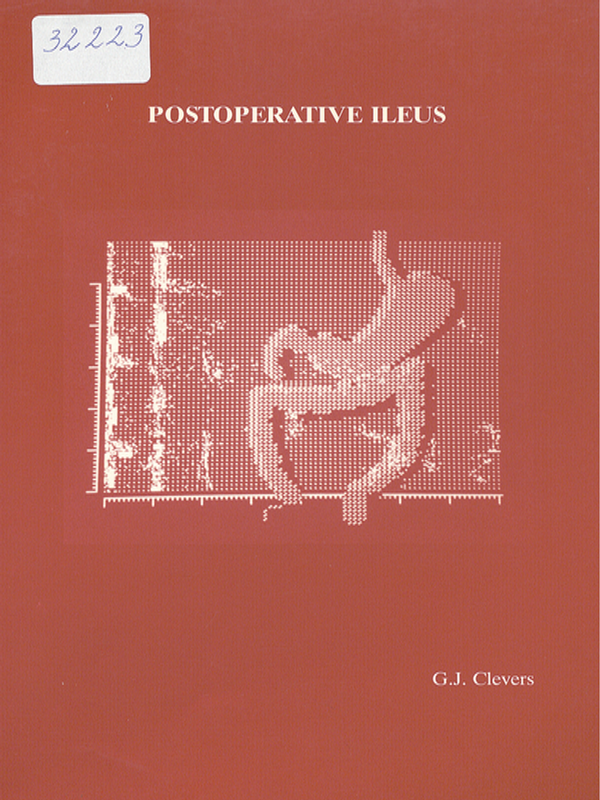 Postoperative ileus