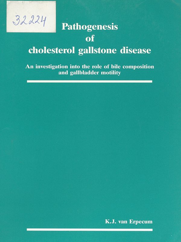 Pathogenesis of cholesterol gallstone disease