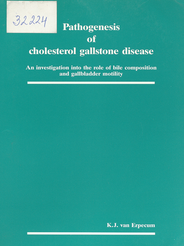 Pathogenesis of cholesterol gallstone disease