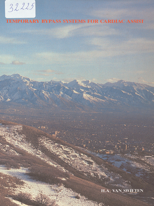 Temporary bypass systems for cardiac assist