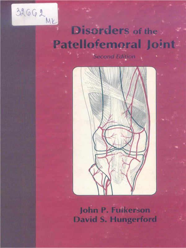 Disorders of the patellofemoral joint