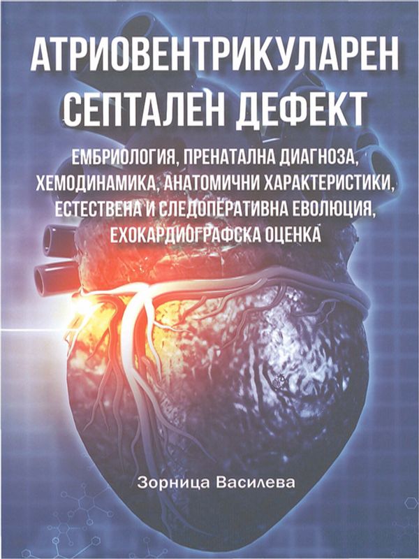 Атриовентрикуларен септален дефект