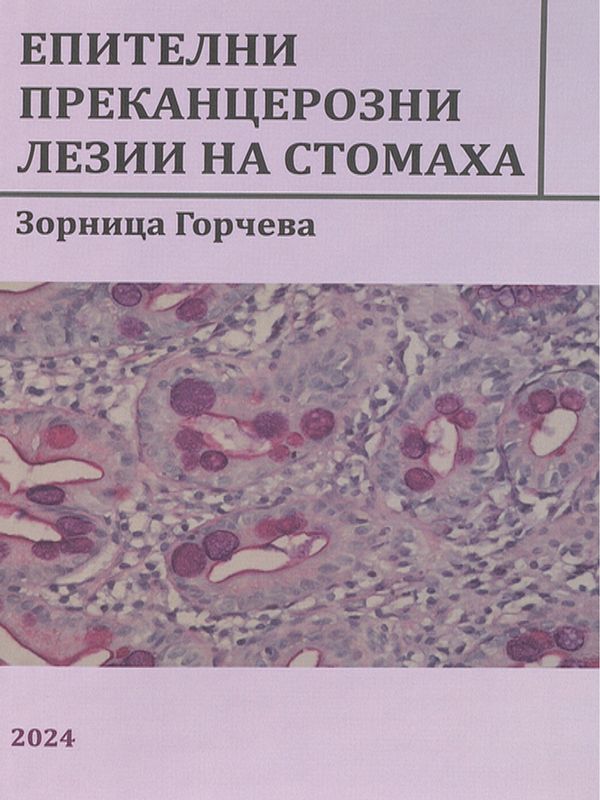 Епителни преканцерозни лезии на стомаха