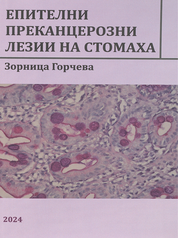 Епителни преканцерозни лезии на стомаха